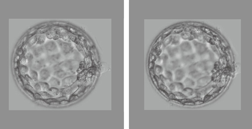 多基因胚胎筛查的公众认同与隐忧：哈佛研究揭示伦理与技术之间的巨大鸿沟